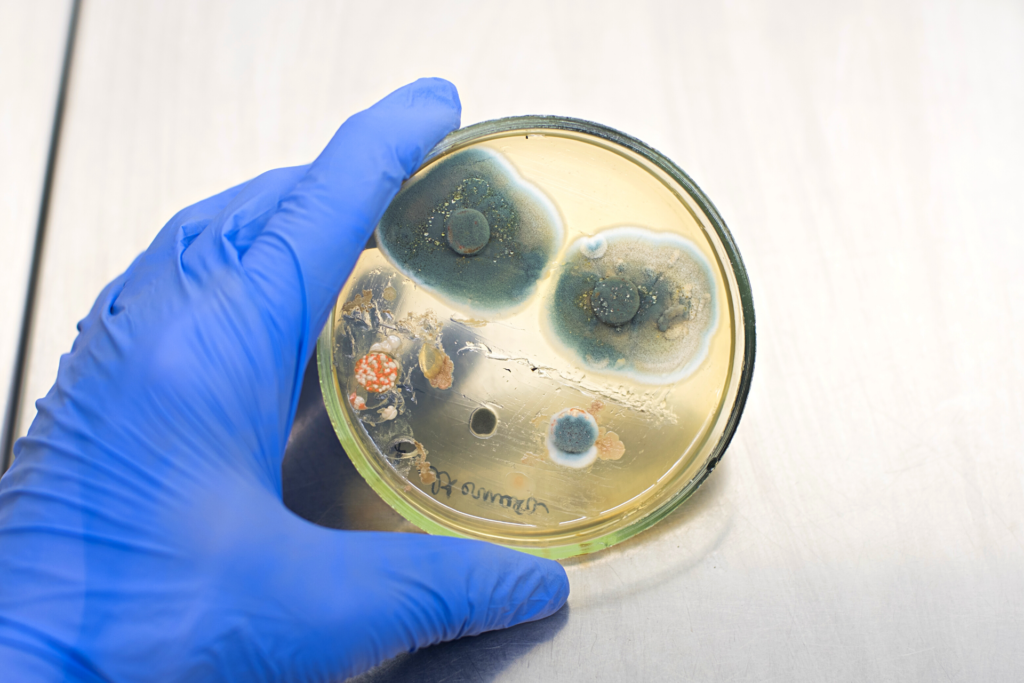 man with petri dish of mold for testing